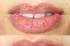 GLOW LIPS: Fran Rocha apresenta técnica inovadora que promete contorno labial, rejuvenescimento e hidratação profunda