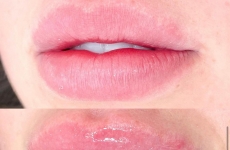 GLOW LIPS: Fran Rocha apresenta técnica inovadora que promete contorno labial, rejuvenescimento e hidratação profunda